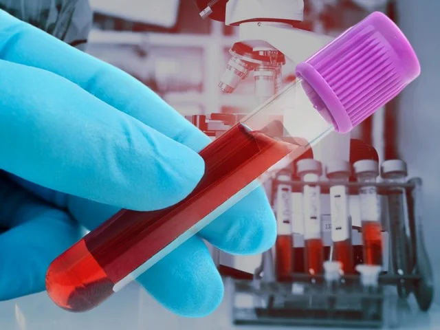 Биохимический анализ крови