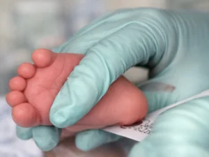 Фенилкетонурия – тяжелое наследственное заболевание